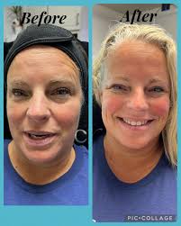 Uniquely You Med Spa