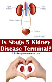 7 Perfect Tricks Msk Kidney Disease Chronic Kidney Disease Nurse Teaching Chronic Kidney Disease Kidney Disease Kidney Disease Stages Kidney Disease Symptoms
