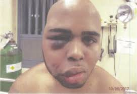 The HALT Solitary Confinement Act Could Save Those From Wrongful Death in  NY: The Story of Dante Taylor & His Mother's Fight for Justice