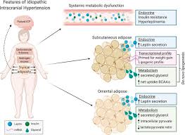 Tests for chronic intracranial hypertension. Jci Insight Systemic And Adipocyte Transcriptional And Metabolic Dysregulation In Idiopathic Intracranial Hypertension