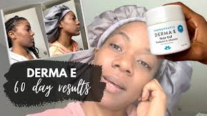 For instance, it might s. How I Treat My Acne Scars 60 Day Results Using Derma E Scar Gel And Reduce Acne Scars Set Youtube