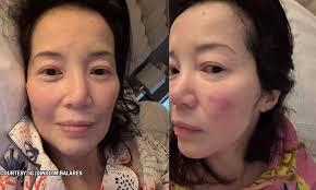 Kris Aquino muntik nang mabagok ang ulo, niligtas ni Bimby!