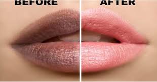 Top 7 Tips To Lighten Dark Lips Pink Lip Scrub Dark Lips Pink Lips