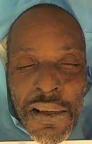 Logan Sterling Unclaimed Person from Bronx, New York