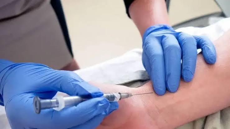 How to Perform ABG Tests Accurately: Best Practices for Medical ...