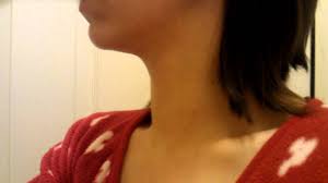 I do try to find things to be greatful for. What Does Thyroid Cancer Look Like Youtube