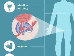 In fact, most people don't even know what it does. Prostate Cancer Signs Symptoms And Complications