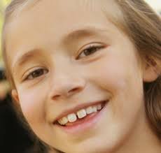 UNDERSTANDING TEACHERS' PERSPECTIVES ON