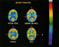 Music And The Brain Music And The Brain Music Therapy Body Is A Temple