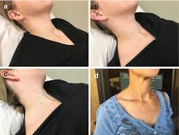 Image result for Neck Exam