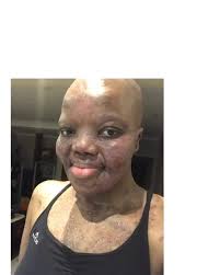 Ladies, I really need your help. I was going to dye my hair but I decided  to wait until the end of August or when I can figure out how to help