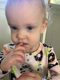 I know this may not be Autism related. But my 8 year olds eyes are so dark  under & idk why.. is there any reasons for this? Im pretty sure he sleeps