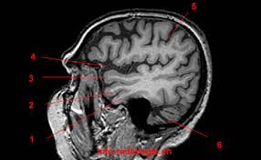 Atlas Of Brain Mri W Radiology