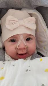 Au CHU de Nantes, cette prothèse change la vie de bébés touchés par une  malformation de la bouche