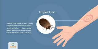 Penyakit Lyme Disebabkan Oleh Bakteri Yang Ditularkan Melalui Gigitan Kutu Berkaki Hitam Yang Biasa Tinggal Di Daerah Hutan Lebat Dengan Rum Penyakit Kutu Kaki