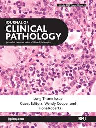 Other abdominal subtypes (also discussed separately) include: Challenges And Controversies In The Diagnosis Of Malignant Mesothelioma Part 2 Malignant Mesothelioma Subtypes Pleural Synovial Sarcoma Molecular And Prognostic Aspects Of Mesothelioma Bap1 Aquaporin 1 And Microrna Journal Of Clinical Pathology