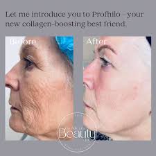 Carmelle Lea Beauty Clinic