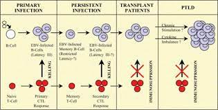 Childhood Post Transplant Lymphoproliferative Disorder Sciencedirect