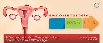 Endometriosis is the abnormal growth of endometrial cells outside the uterus. The Prevalence And Severity Of Endometriosis Today Endonews