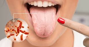 Image result for Periodontal Abscess