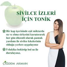 Elma Sirkesi Cildin Rengini Acma Ve Sivilceleri Yok Etme Konusunda Oldukca Etkilidir Ben De Size Uygulamasi Ve Hazirlamasi Ko Hand Soap Bottle Hand Soap Soap