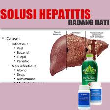 Penyebab sakit ulu hati beserta obatnyaподробнее. Obat Sakit Ulu Hati Buat Ibu Menyusui Maxi Pack Shopee Indonesia