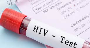 Hivinfection weakens your immune system, making you much more likely to develop many infections and certain types of cancers. Unaids Jeder Vierte Hiv Infizierte Weltweit Weiss Nichts Von