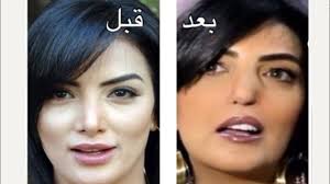 فنانات اجرت عمليات تجميل فاشلة Art Incoming Call Screenshot