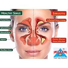 ANCS Durable Plastic Jal Neti Pot For Sinus, Nose Wash System With  Waterpulse