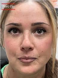 David Massry's Instagram, Twitter & Facebook