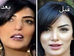 5 فنانات تغيرن بعد عمليات التجميل. Ù‡ÙŠÙØ§Ø¡ ÙˆÙ‡Ø¨ÙŠ Ù‚Ø¨Ù„ Ø¹Ù…Ù„ÙŠØ§Øª Ø§Ù„ØªØ¬Ù…ÙŠÙ„ ÙŠÙˆØªÙŠÙˆØ¨