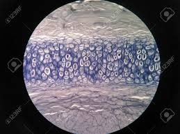 The section has been ground and dried, hence the lacunae… Cross Section Human Cartilage Bone Under Microscope View Stock Photo Picture And Royalty Free Image Image 81293378