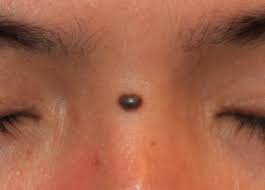 They often appear as small, dark brown spots and are caused by clusters of pigmented cells. 17 Simple Ways To Get Rid Of Moles On Any Part Of The Body Hubpages