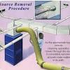 Compare homeowner reviews from 9 top jacksonville clean ducts and vents services. 1