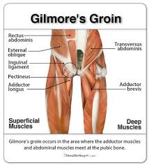 Often groin strain occurs in the area of inguinal ligament. 10 Groin Strain Injury Ideas Soft Tissue Injury Muscle Injury