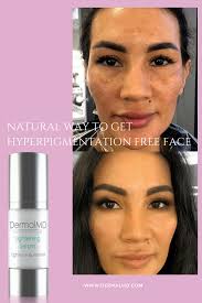 Make Skin Lighter Shop Lightening Serum Skin Darkening Hyperpigmentation