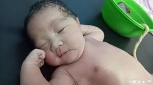 Bayi yang lahir dengan kondisi berat badan kurang atau bblr cenderung memiliki resiko tinggi terhadap penyakit, bahkan komplikasi. Yuk Kenali Berbagai Masalah Kulit Bayi Baru Lahir