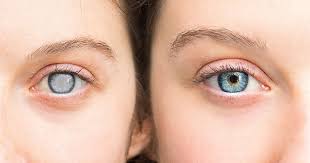 Cataratas do iguaçu (em castelhano: Cataratas Son Faciles De Tratar