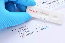 The difference is the way the virus is detected compared to the pcr test. Sars Cov 2 Covid 19 Diagnosis By Igg Igm Rapid Test Biotrend