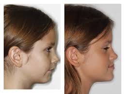 Rachel Barnhart, DDS