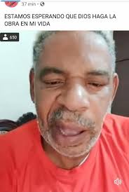 TRISTEZA #ECUADOR MARIO CABEZAS, ACTOR RECONOCIDO COMO "TILIN, TILIN,  SUFRIÓ UN DERRAME FACIAL El tomó la decisión de pronunciarse en redes  sociales luego de que la semana pasada sufriera una parálisis fácil. "