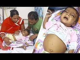 My 9 Month Old Is Suffering From Liver Disease Please Save My Baby I Can T Live Without Him Youtube