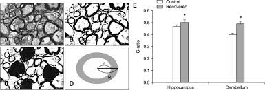 How to calculate ratio : A Stepwise Image Conversion Process To Calculate The G Ratio A An Download Scientific Diagram