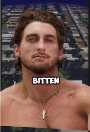 TooTurnTony Alligator Attack #fyp #foryou #tooturnttony #aligator