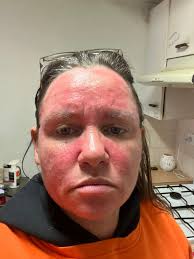 Hi,moved house and just been told by my new Gp that they will not give me  my monthly mag sulphate injections despite being told months ago to provide  original letter from Dr