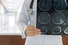 Mauvais Bilan Lipidique Attention Au Risque D Avc Cardiovasculaire Cholesterol Lipides