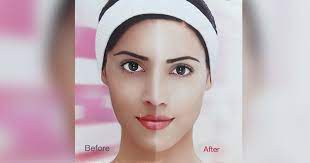 No matter what tone you own, we always want to one must have observed that even the fairest beauties have tried these products and maybe looking for best whitening cream for the face in india. Skin Lightening India S Obsession That Is Becoming A Medical Problem