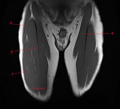 The extrinsic group originate from the torso and attach to the bones of the both groups are innervated by the ulnar and median nerve. Mri Of The Thigh Detailed Anatomy Superior Part W Radiology