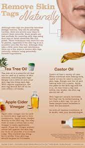 Acneskinsite On Twitter Remove Skin Tags Naturally Skin Tag Removal Skin Tag