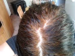 Mes Soins Naturels Elle A Teint Ses Cheveux Blancs Avec Une Coloration Vegetale Cheveux Blancs Astuce Cheveux Cheveux